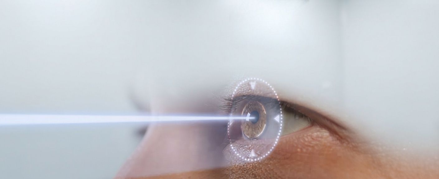Can LASIK Be Done Twice?