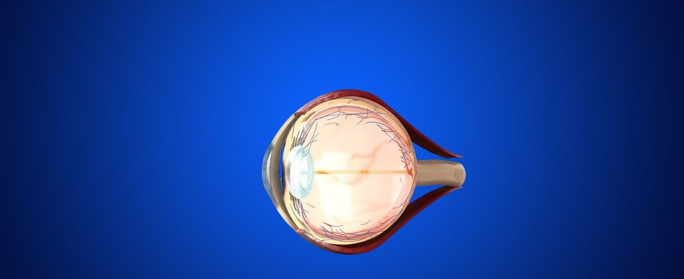What Causes Retinal Detachment? Symptoms, Surgery & Recovery Explained