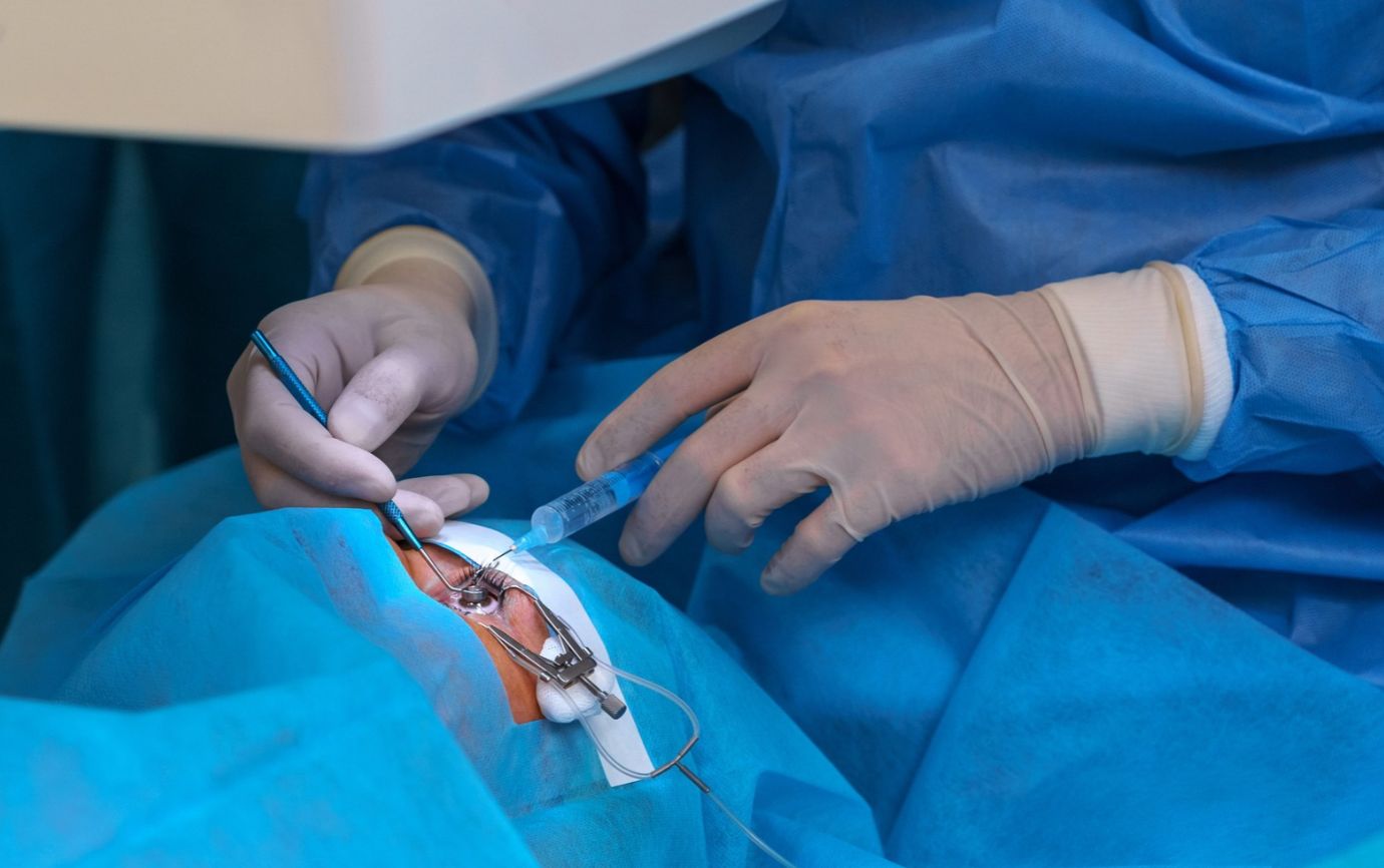 Femto Cataract Surgery Benefits and Recovery