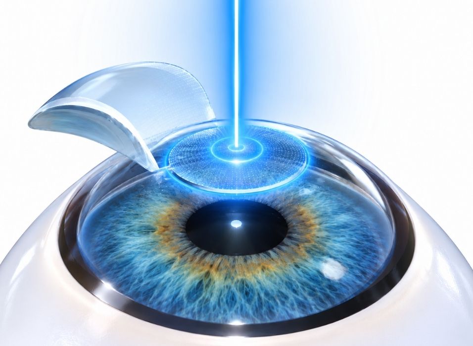 Surya Eye advanced LASIK care