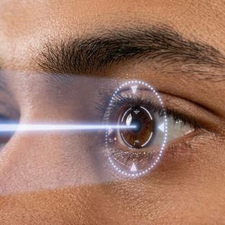 LASIK & Laser Vision Correction