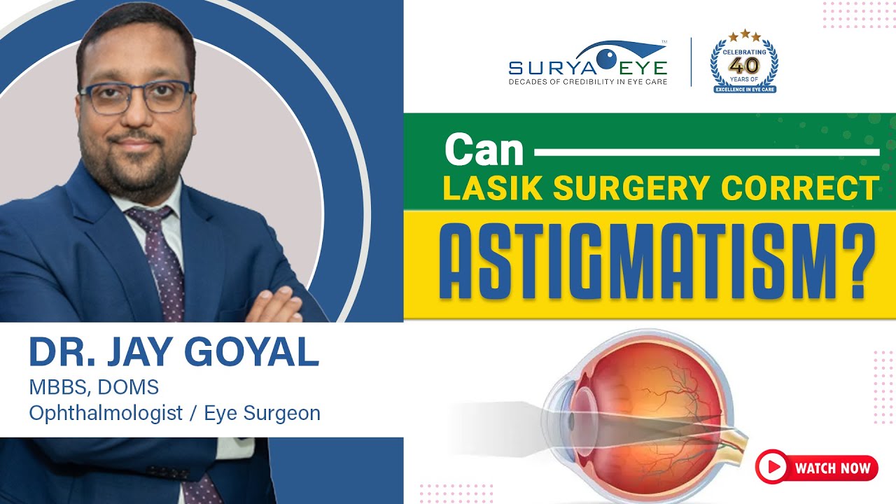 LASIK for Astigmatism: Correcting High Astigmatism and Improving Vision Quality